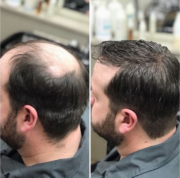 Maintaining Your Hair