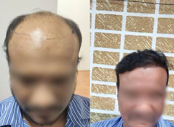 Before and After 6