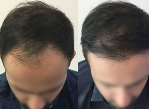 Before and After 7