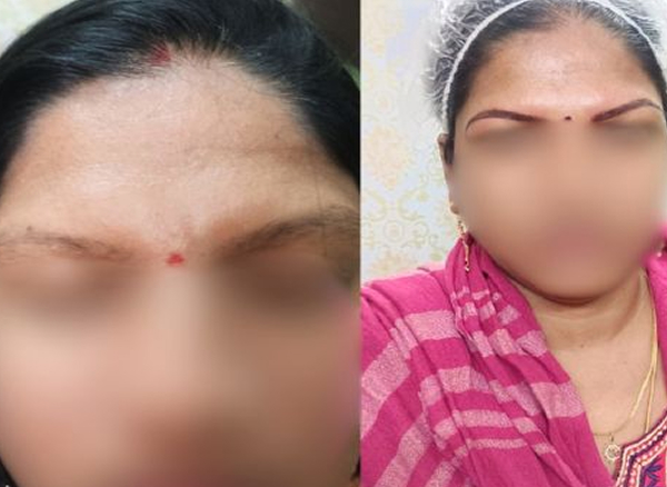 Before and After 6